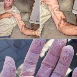 Man Stretches His Arm — Doctors Say This Is What Actually Happened