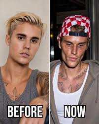Justin Bieber admits that he tested positiv